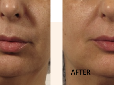 Screenshot 2025-03-04 at 5.35.22 PM